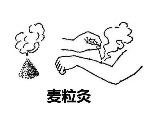 您听说过麦粒灸吗小刺激,大反应
